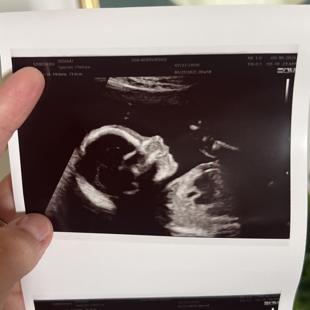 Photo shared by Chelsea for their Babylist baby registry.