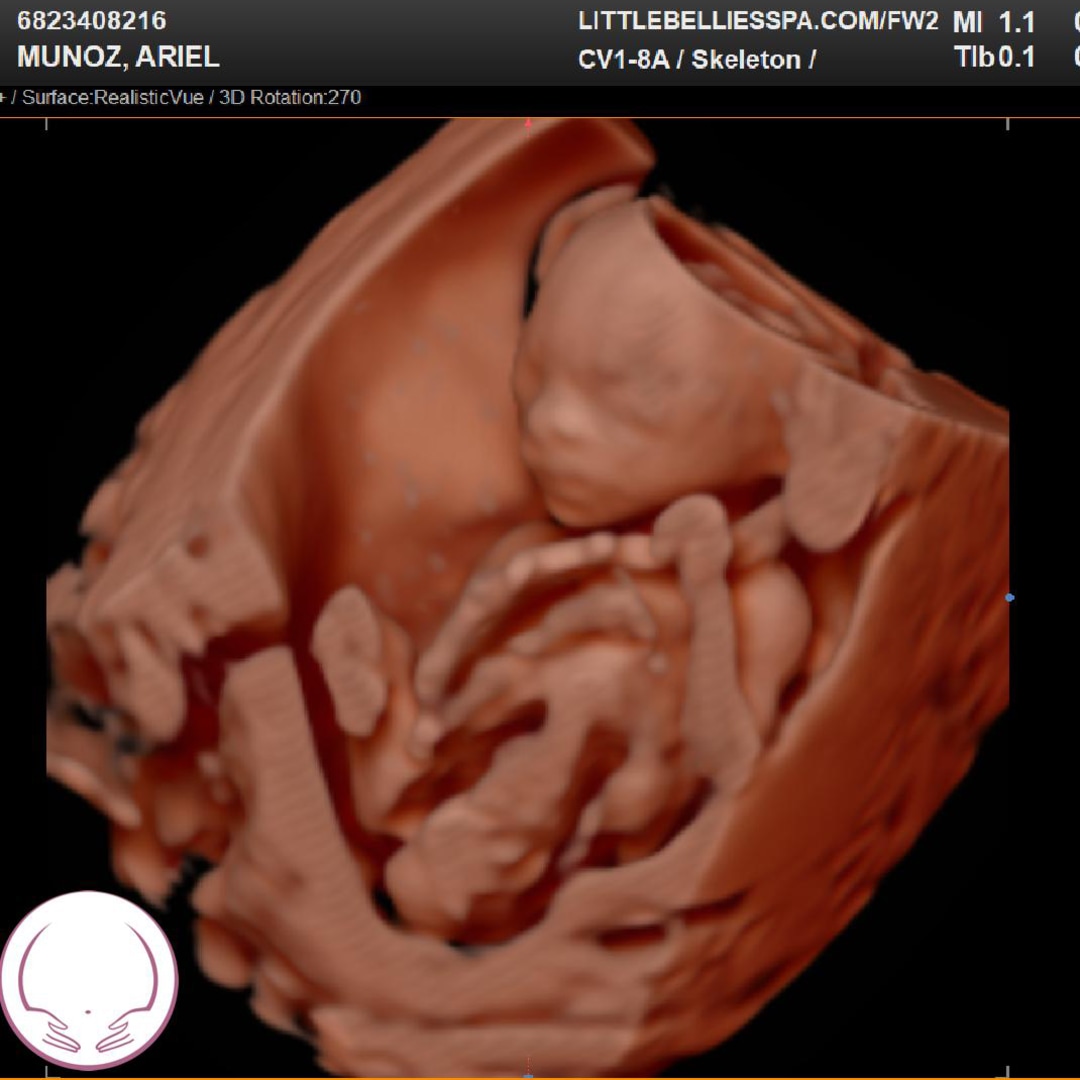 Photo shared by Ariel for their Babylist baby registry.