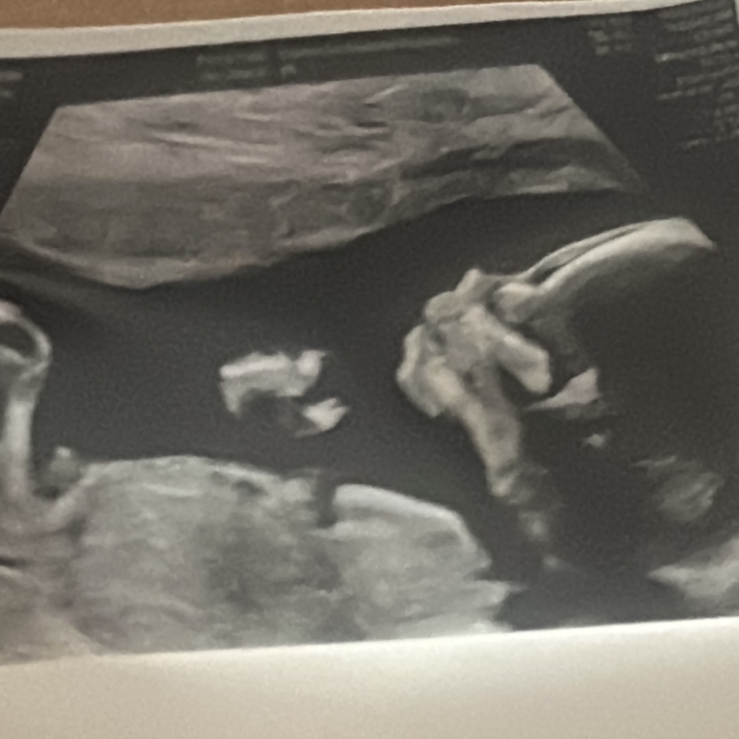 Photo shared by Kirsis for their Babylist baby registry.
