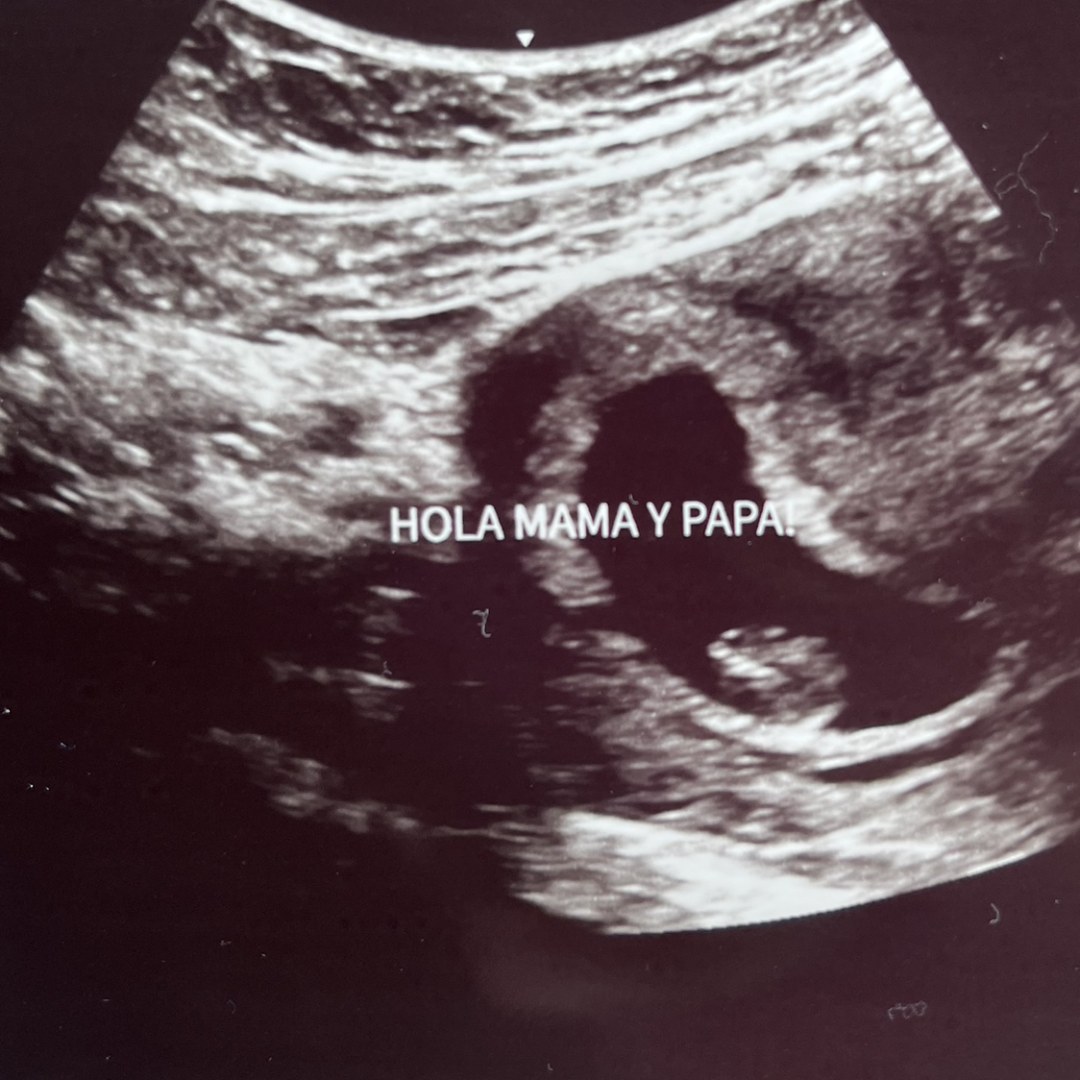 Photo shared by Erica for their Babylist baby registry.