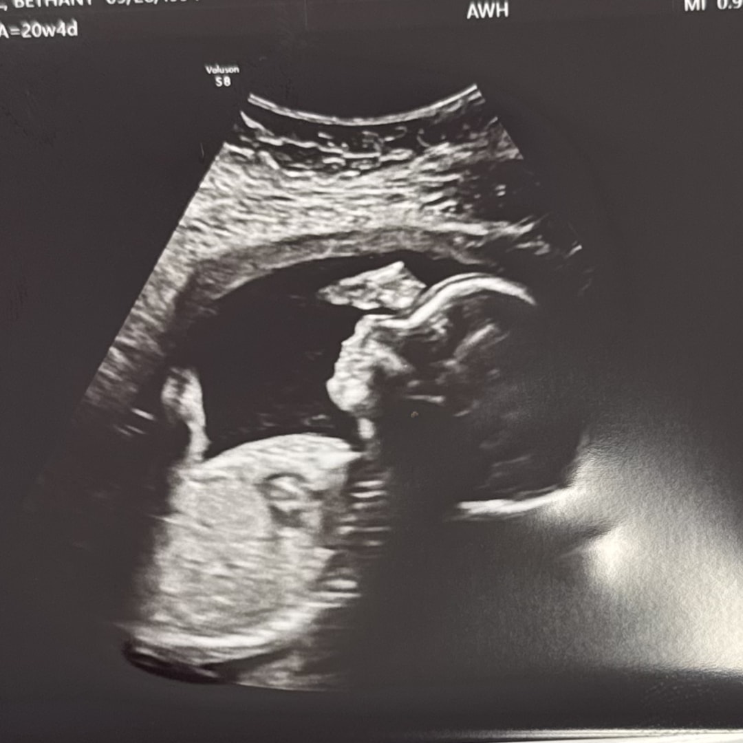 Photo shared by Bethany for their Babylist baby registry.