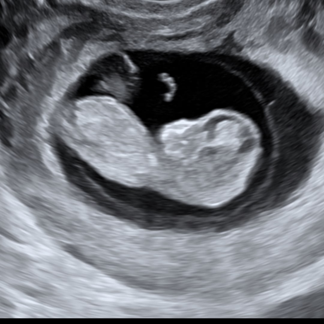 Photo shared by Jordan for their Babylist baby registry.