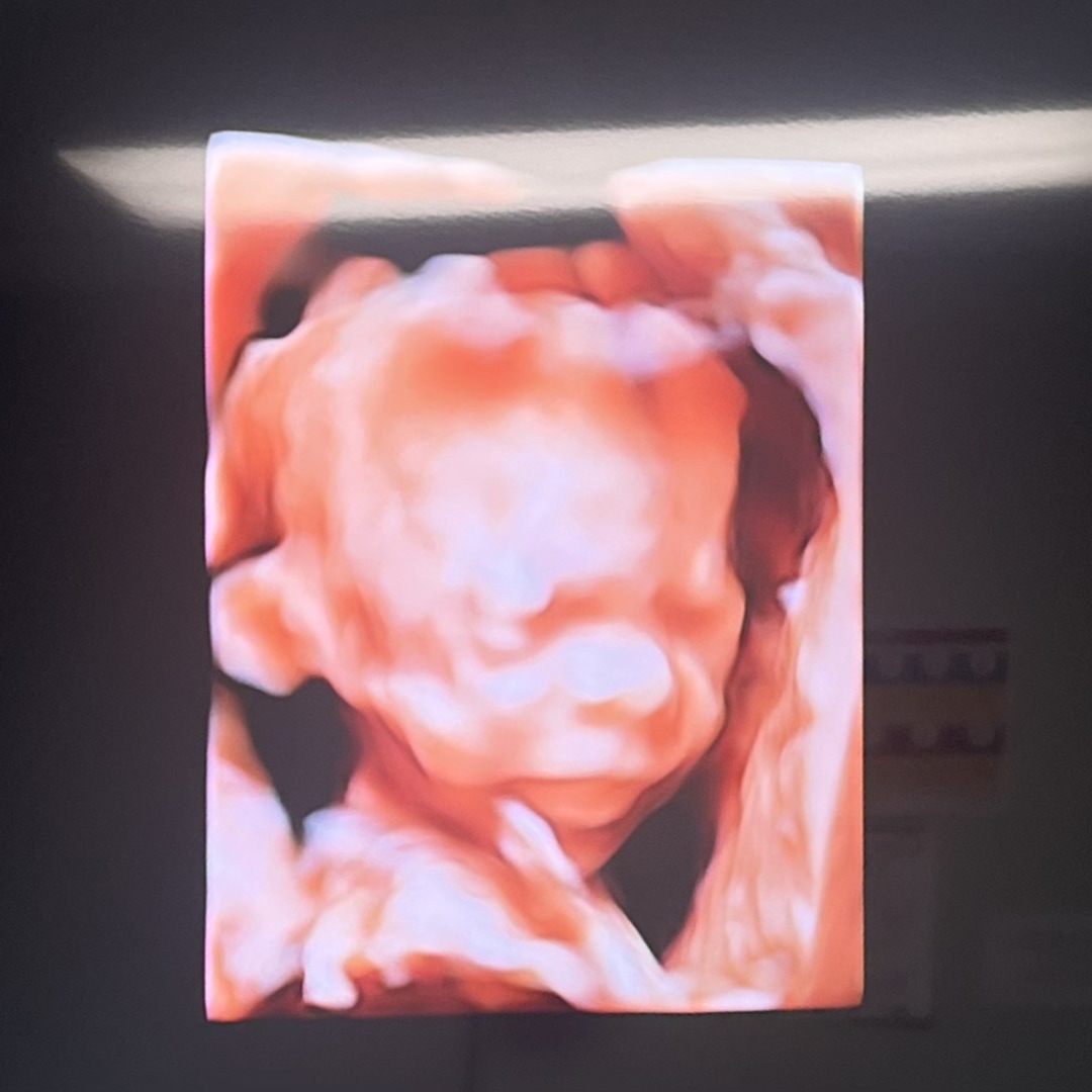 Photo shared by Maggie for their Babylist baby registry.