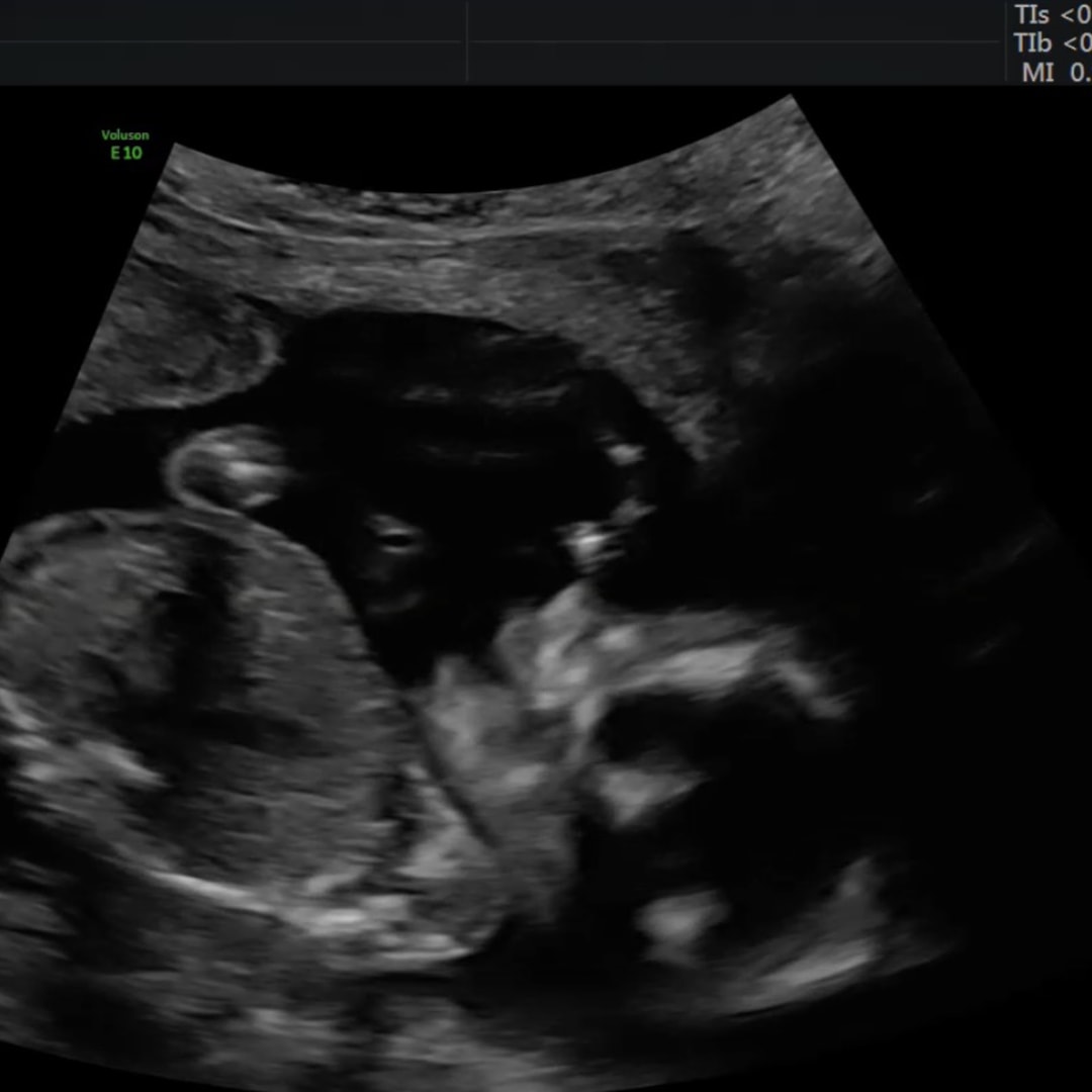 Photo shared by Destany for their Babylist baby registry.