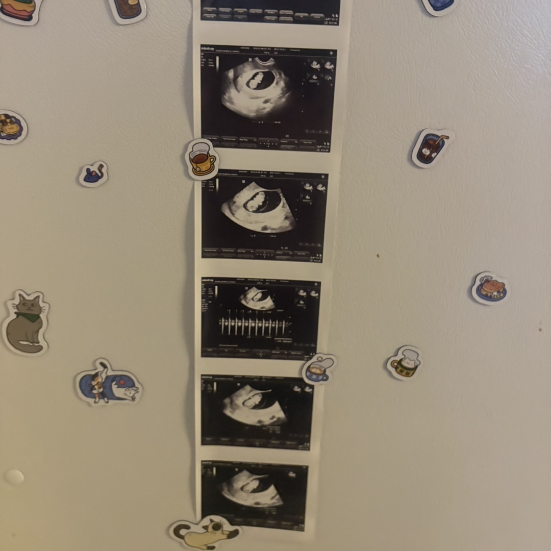 Photo shared by Mya for their Babylist baby registry.
