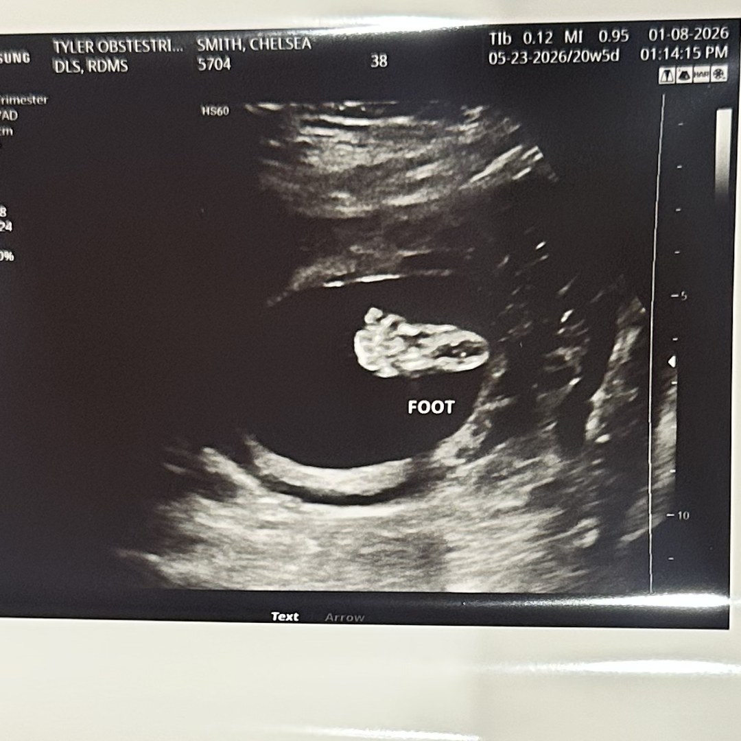 Photo shared by Chelsea for their Babylist baby registry.