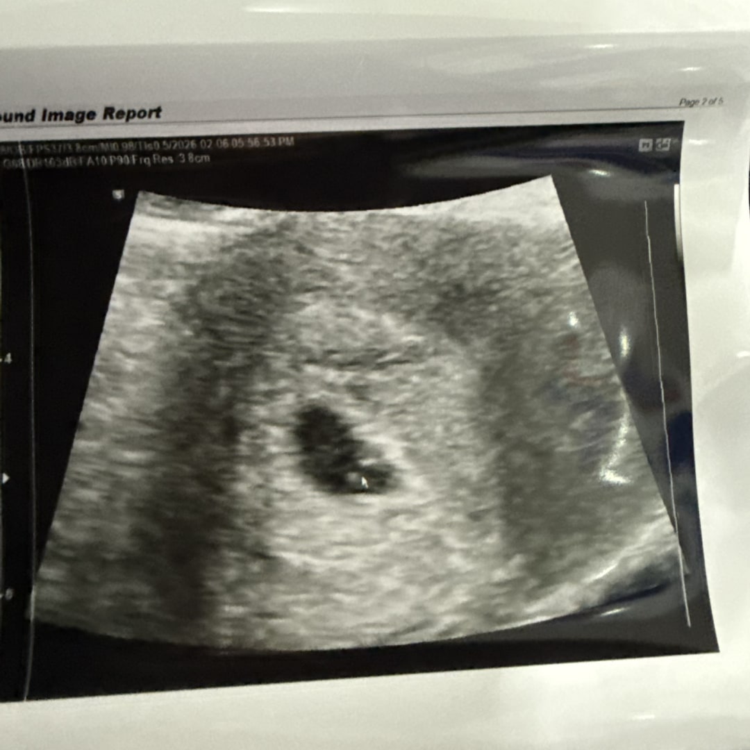 Photo shared by Sarah for their Babylist baby registry.