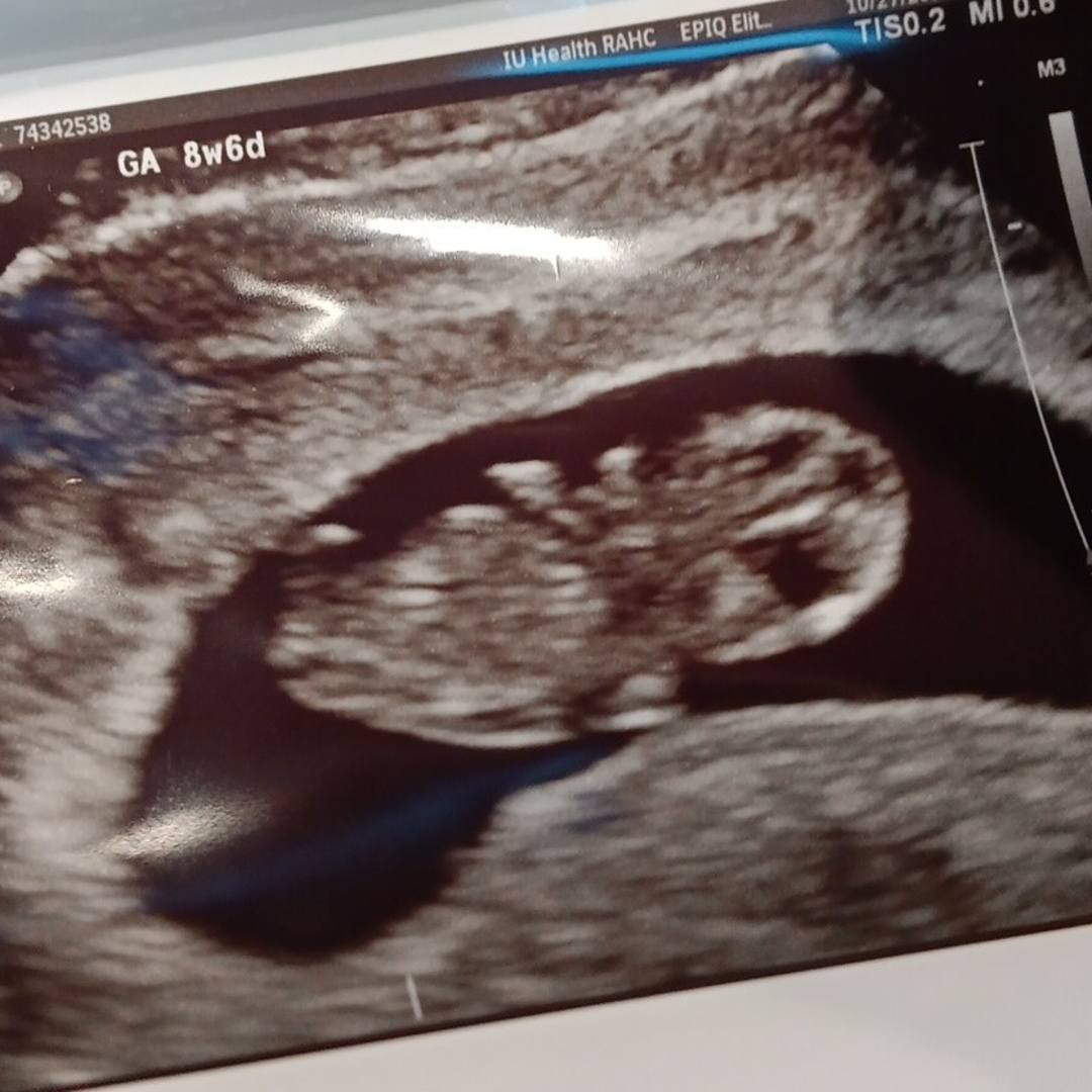 Photo shared by Alicia for their Babylist baby registry.