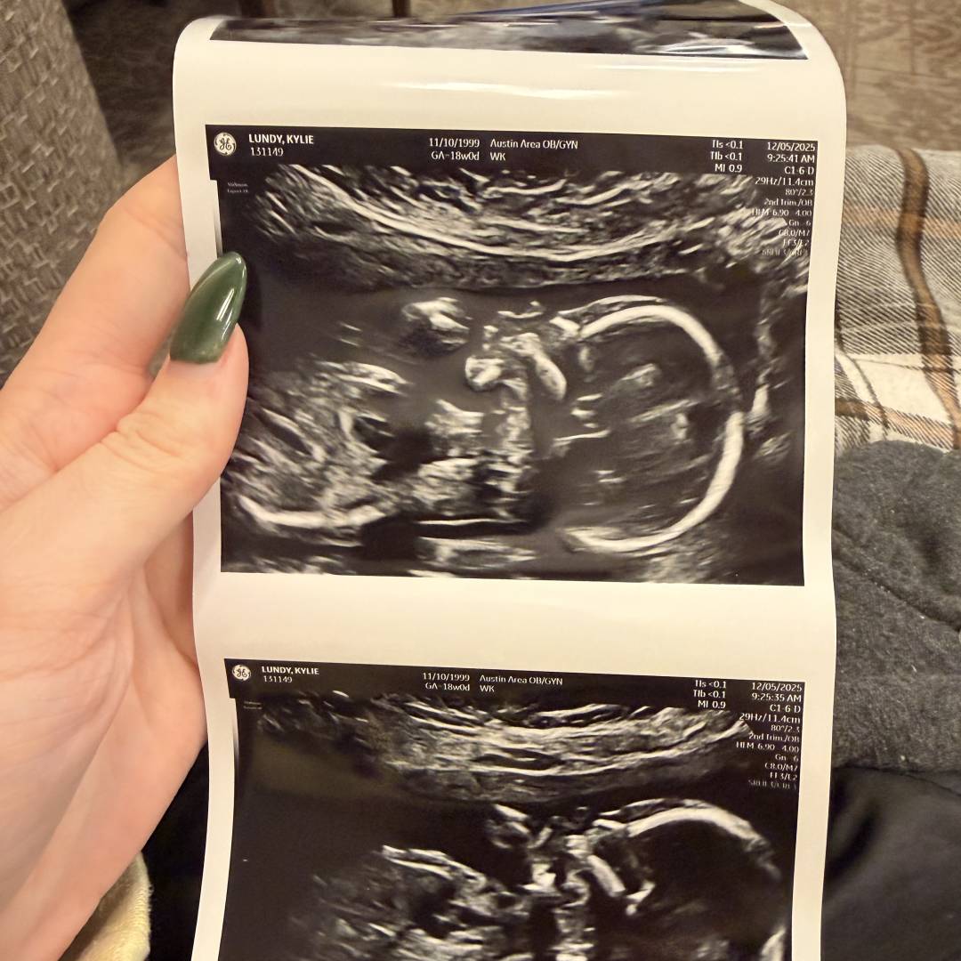 Photo shared by Kylie for their Babylist baby registry.