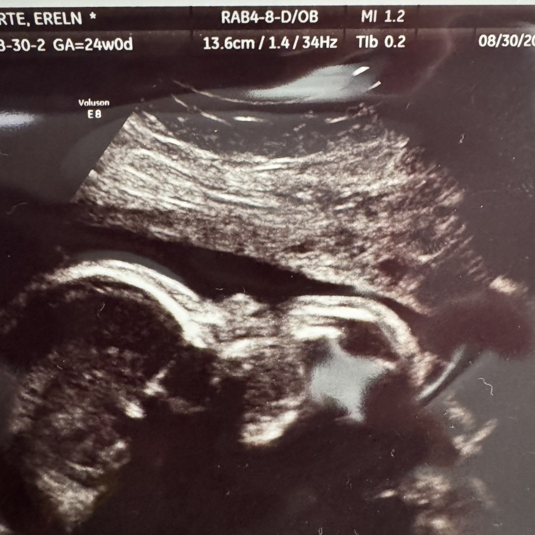 Photo shared by Kareen for their Babylist baby registry.