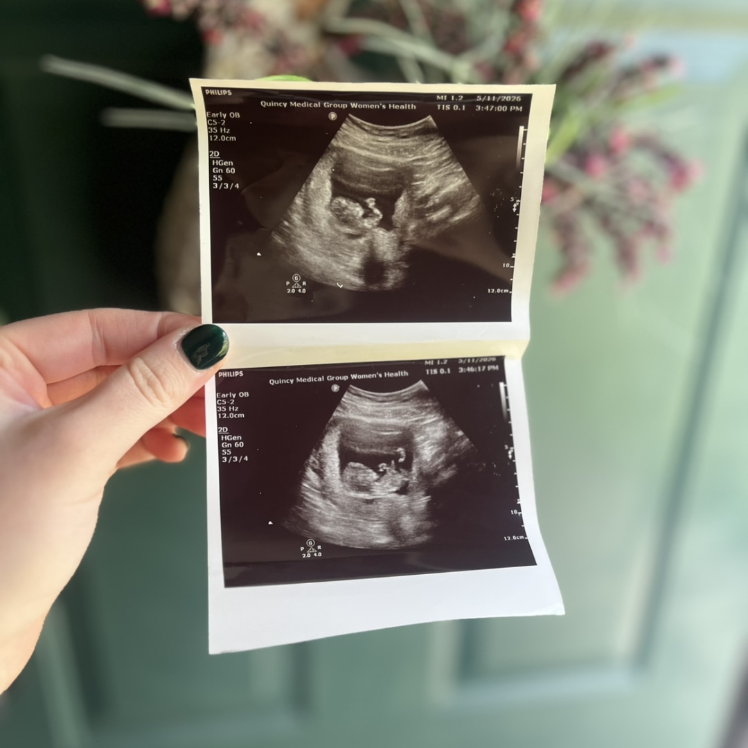 Photo shared by Emma & Ben for their Babylist baby registry.