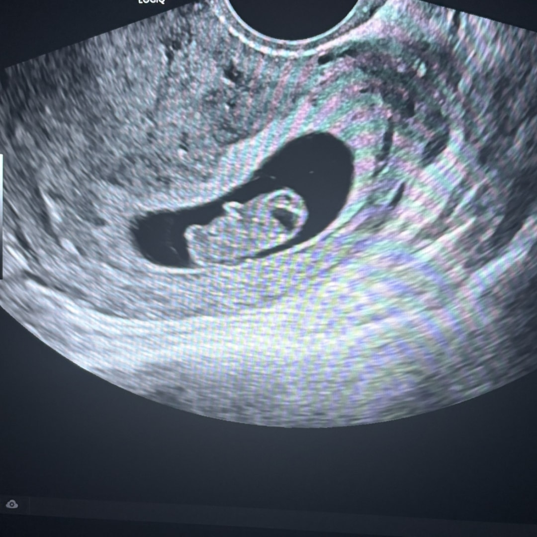 Photo shared by Heather for their Babylist baby registry.