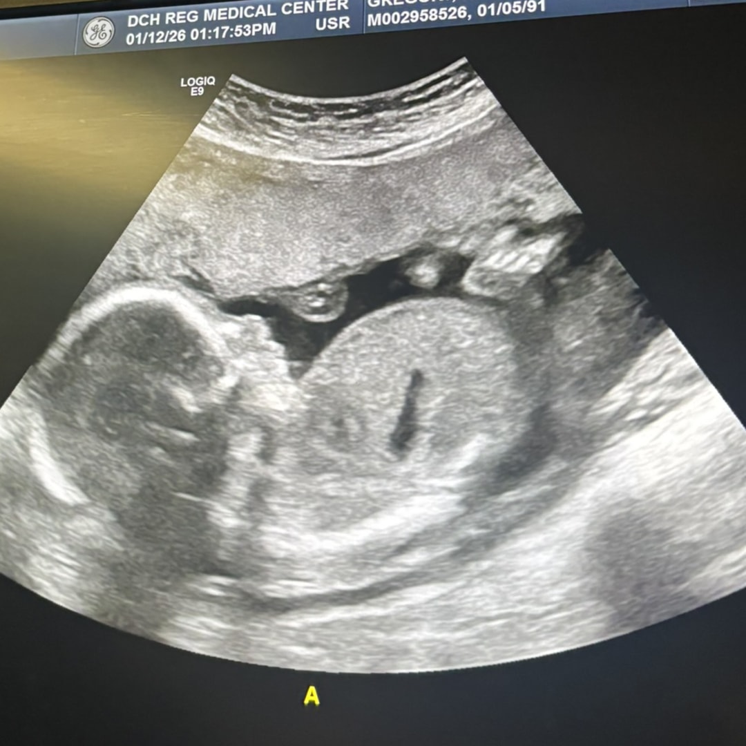 Photo shared by Kristina for their Babylist baby registry.