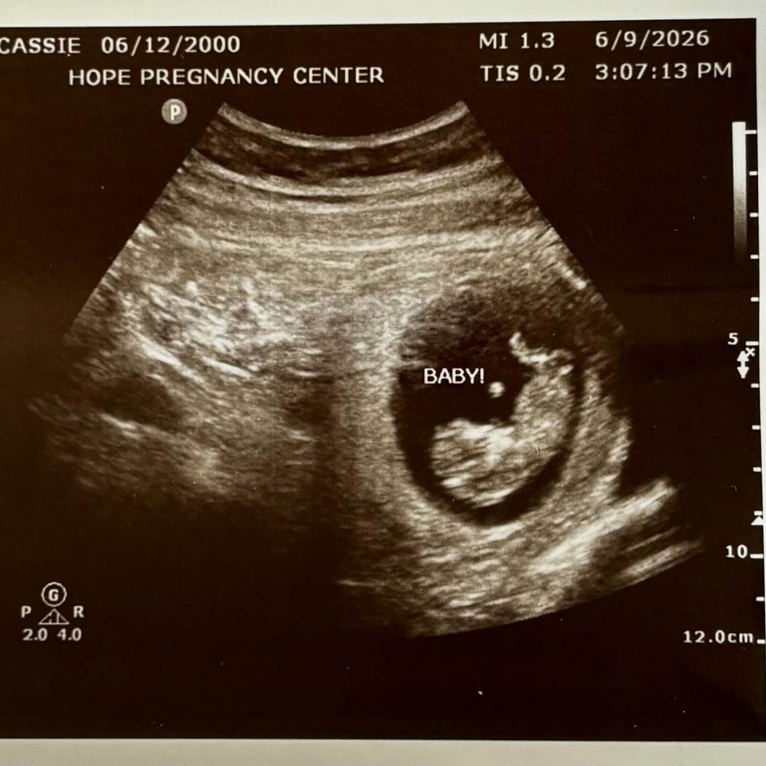 Photo shared by Cassie for their Babylist baby registry.