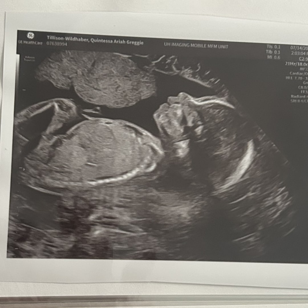 Photo shared by Quintessa for their Babylist baby registry.