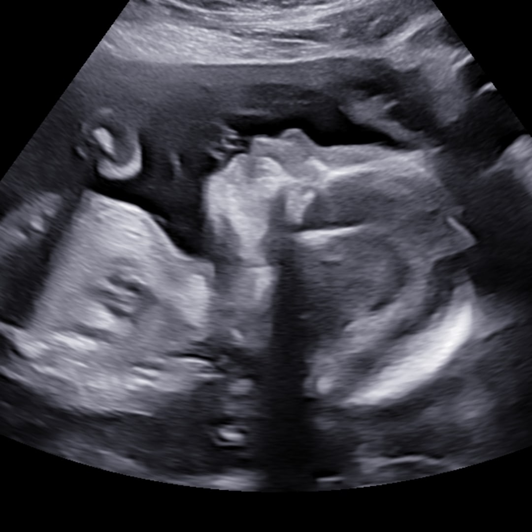 Photo shared by Carly for their Babylist baby registry.