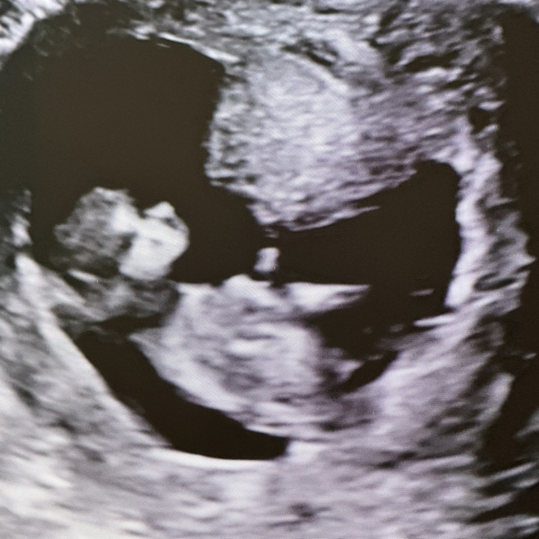 Photo shared by Mario for their Babylist baby registry.