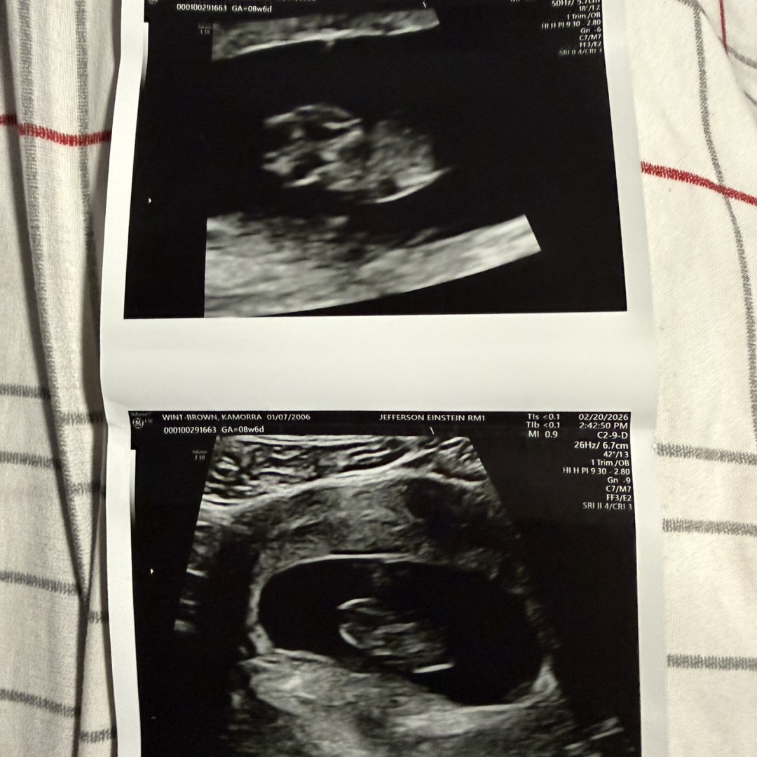 Photo shared by Kamorra for their Babylist baby registry.