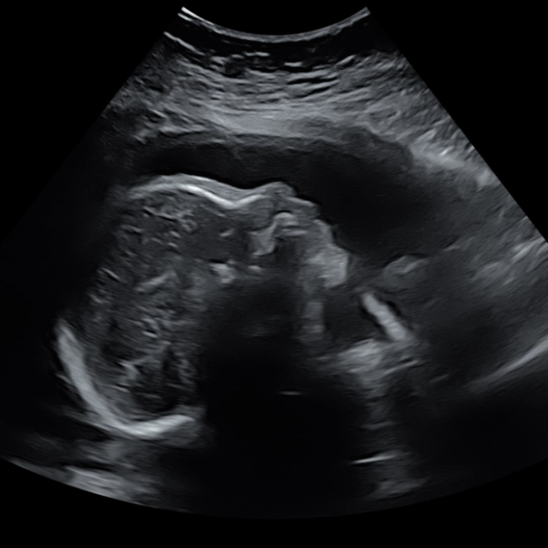 Photo shared by Alyssa for their Babylist baby registry.