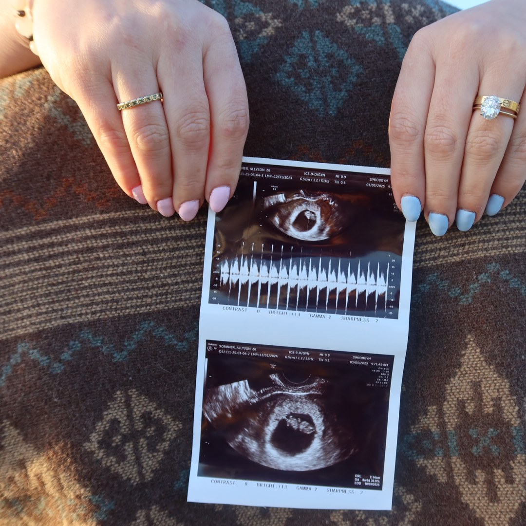 Photo shared by Allyson for their Babylist baby registry.