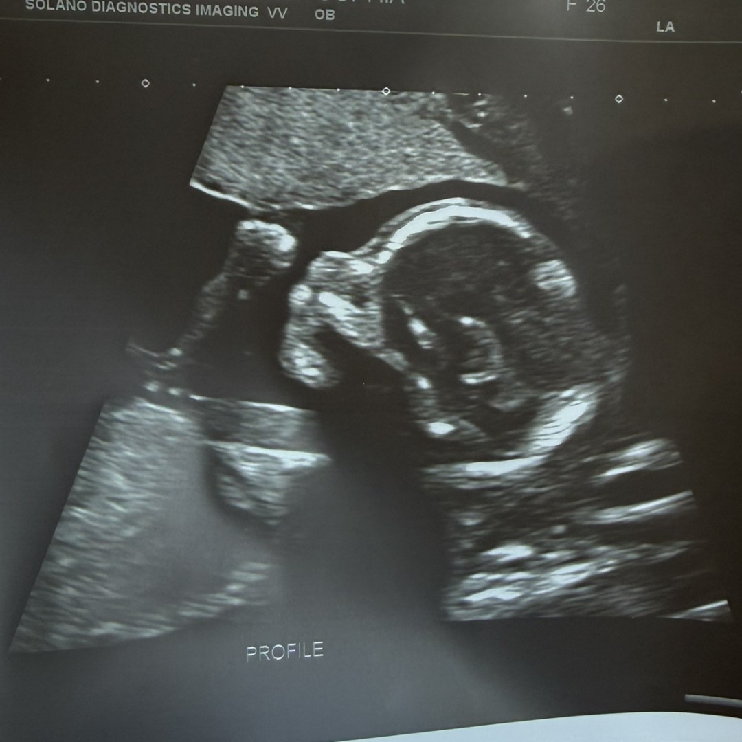 Photo shared by Angela for their Babylist baby registry.