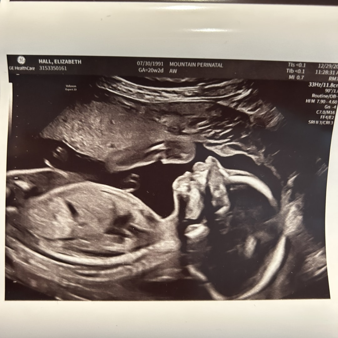 Photo shared by Elizabeth for their Babylist baby registry.