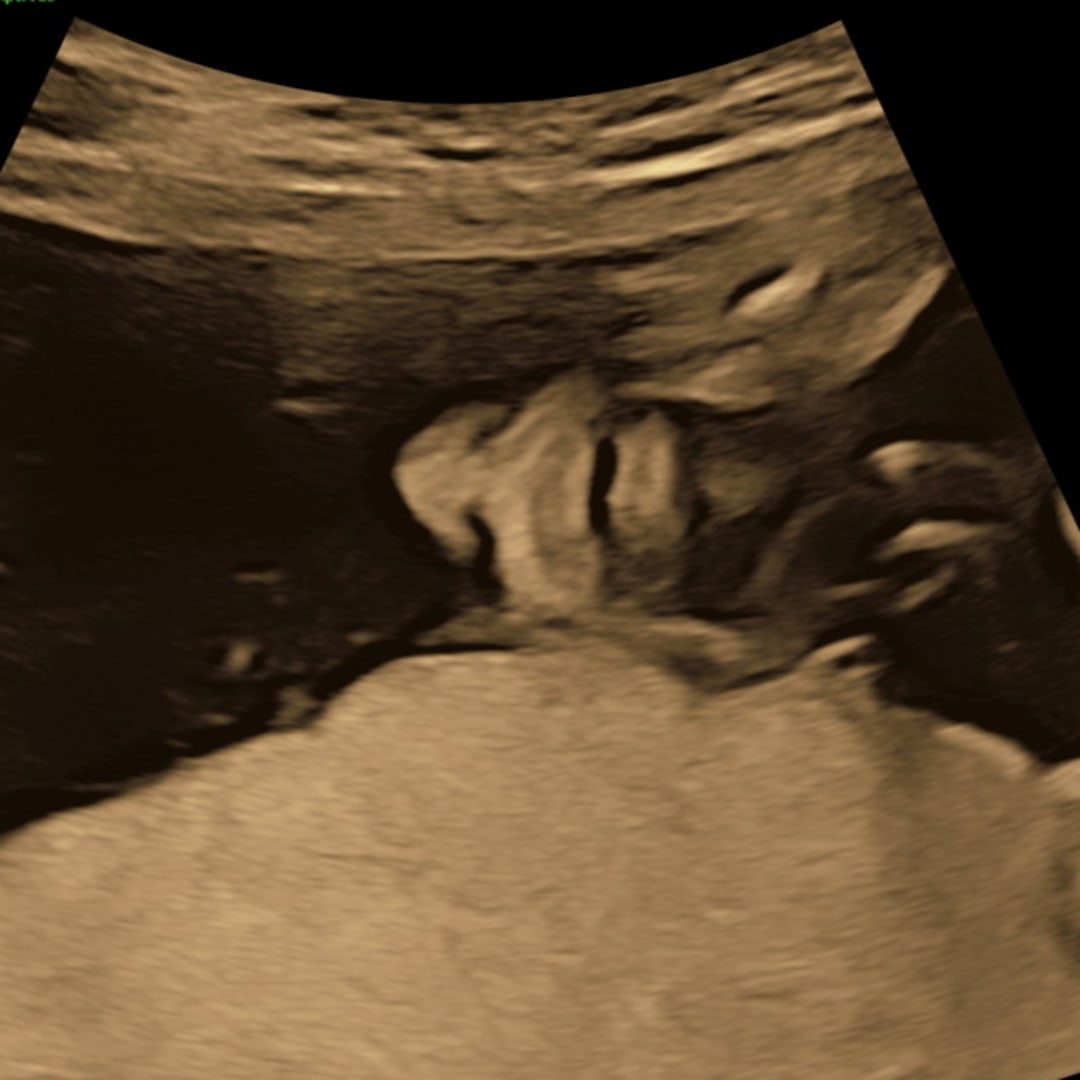 Photo shared by Aubrey for their Babylist baby registry.