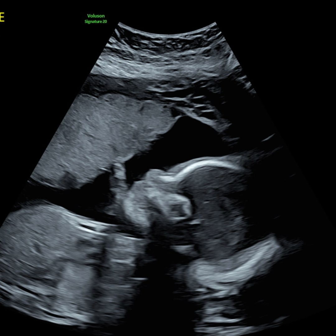 Photo shared by Cheyanne for their Babylist baby registry.