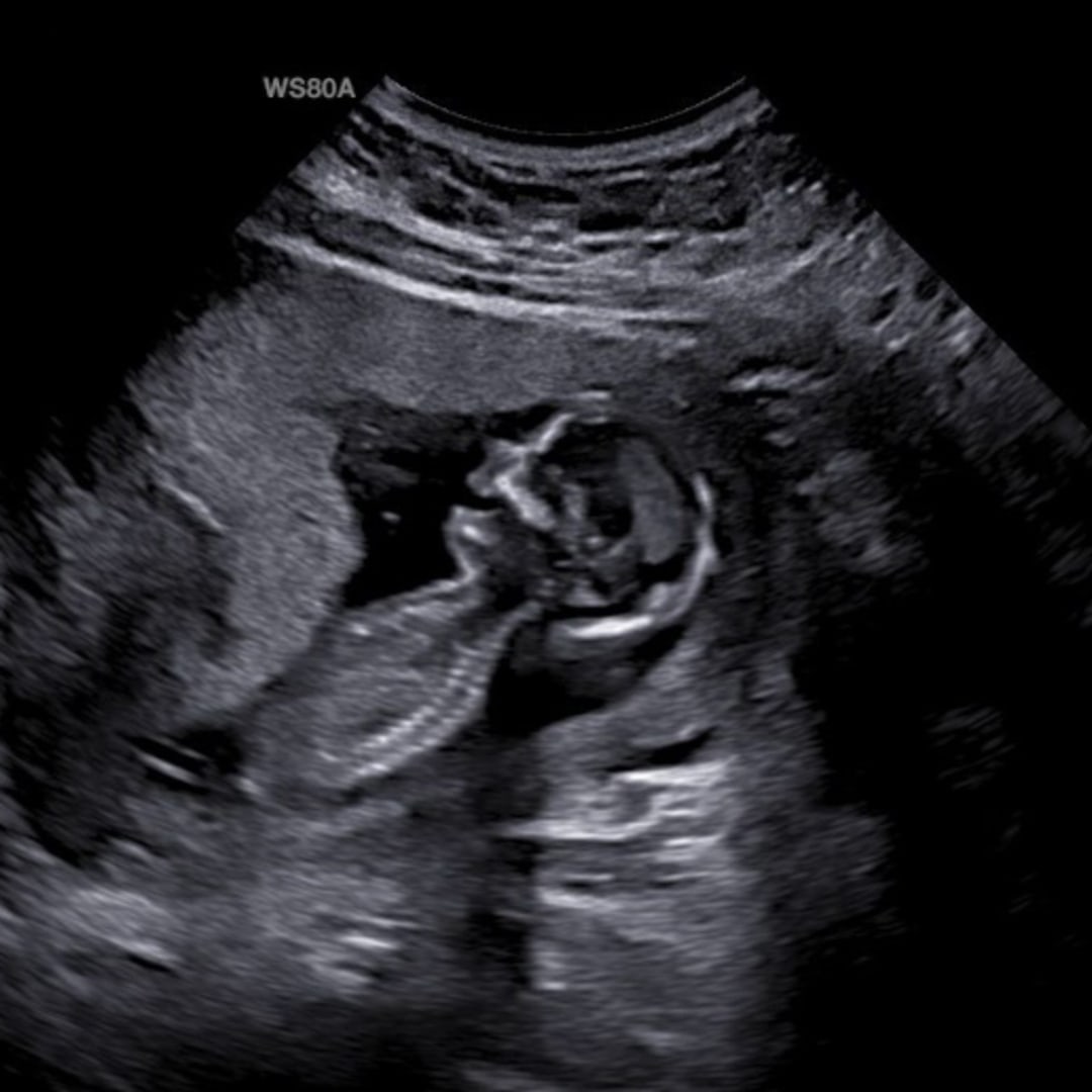 Photo shared by Caitlin for their Babylist baby registry.