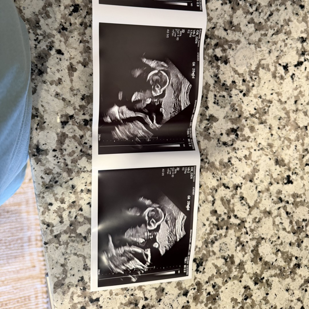 Photo shared by Hanna for their Babylist baby registry.