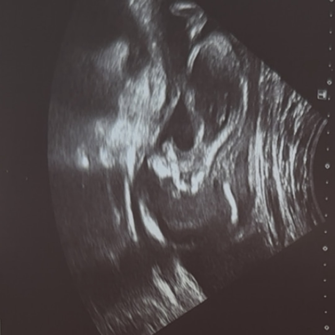 Photo shared by Camryn for their Babylist baby registry.