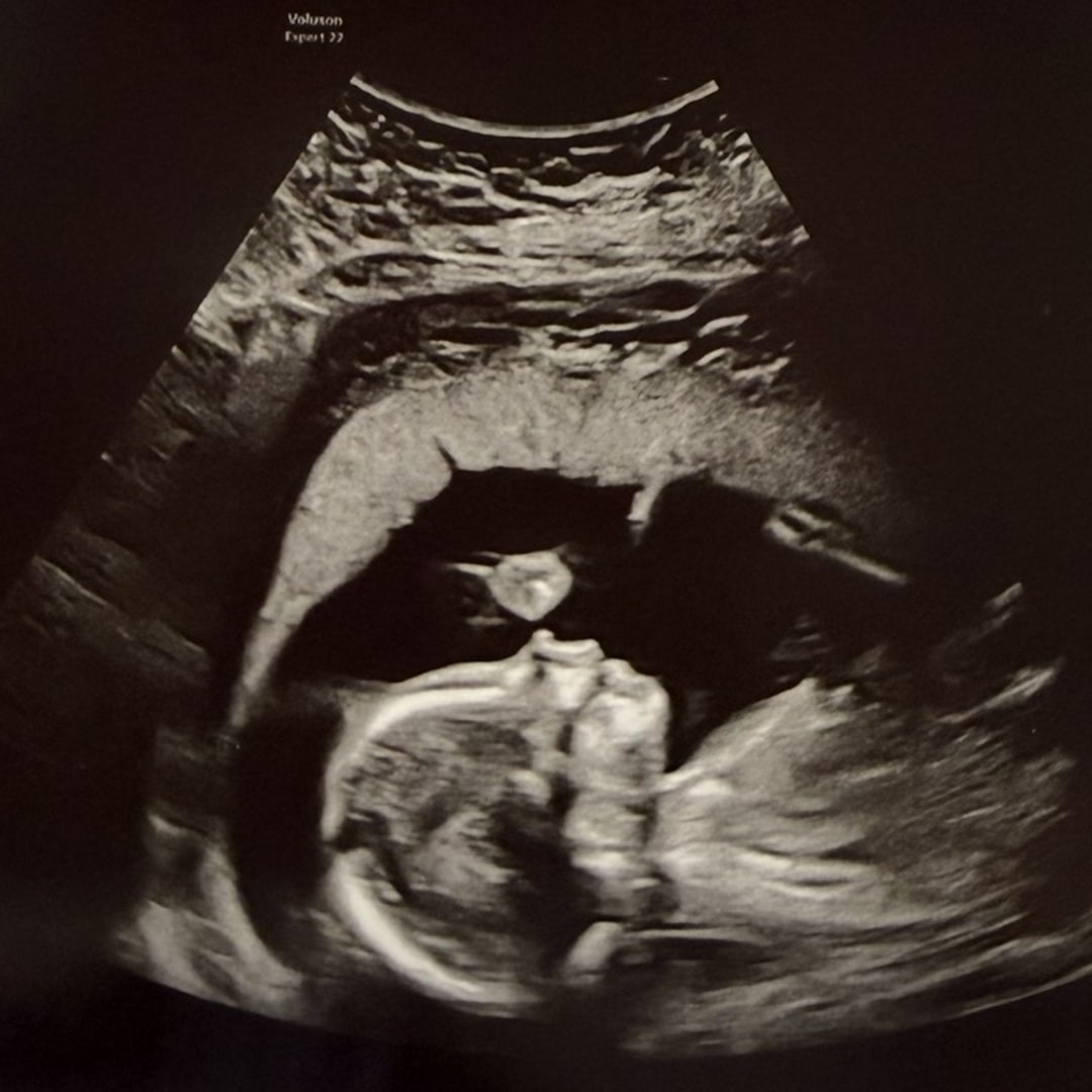 Photo shared by Hannah for their Babylist baby registry.