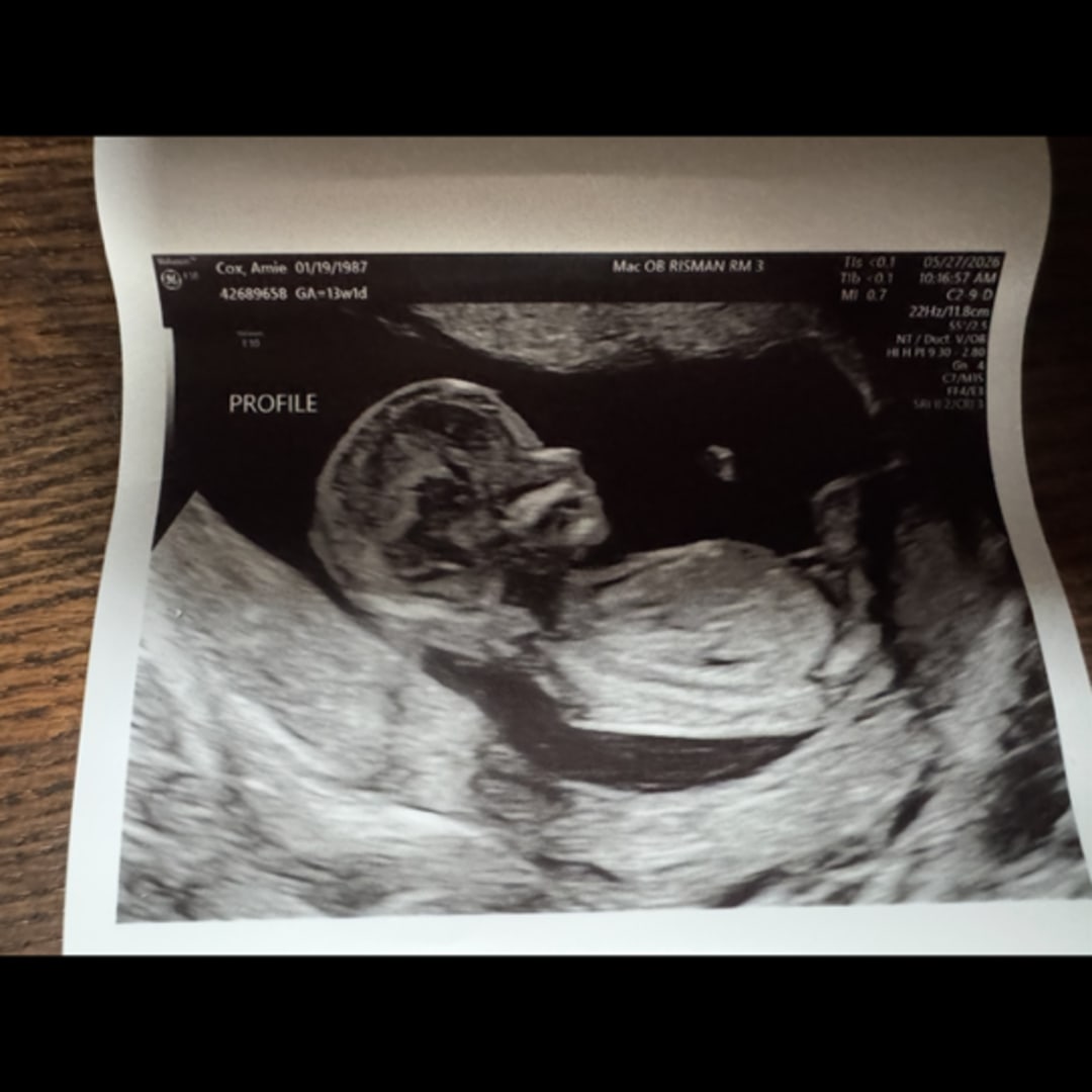 Photo shared by Amie for their Babylist baby registry.