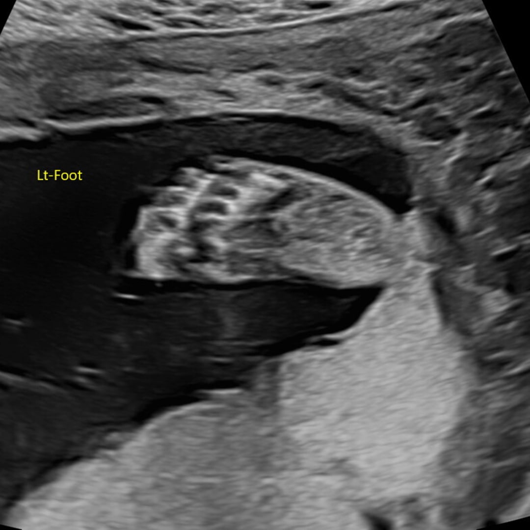 Photo shared by Ali for their Babylist baby registry.