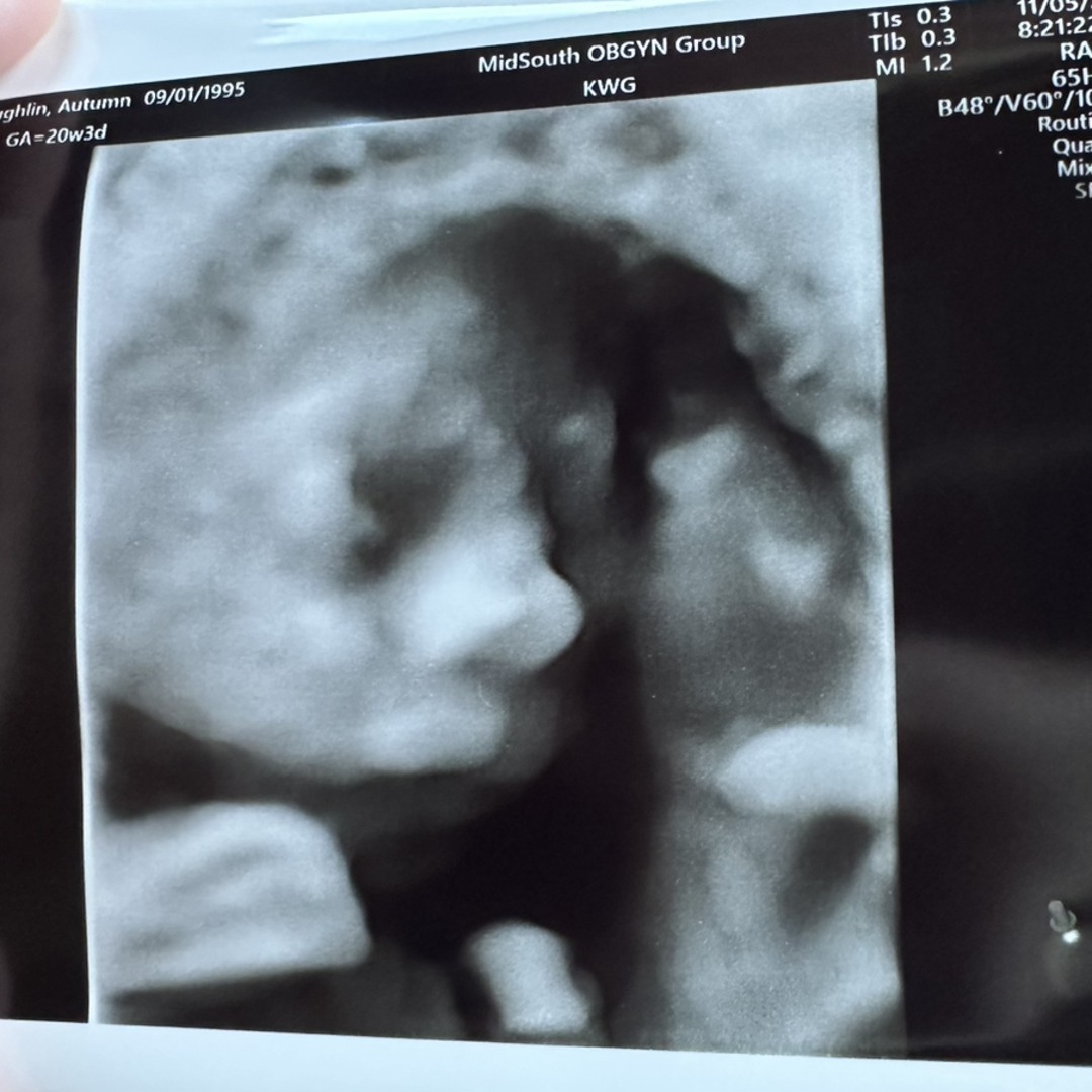 Photo shared by Autumn for their Babylist baby registry.