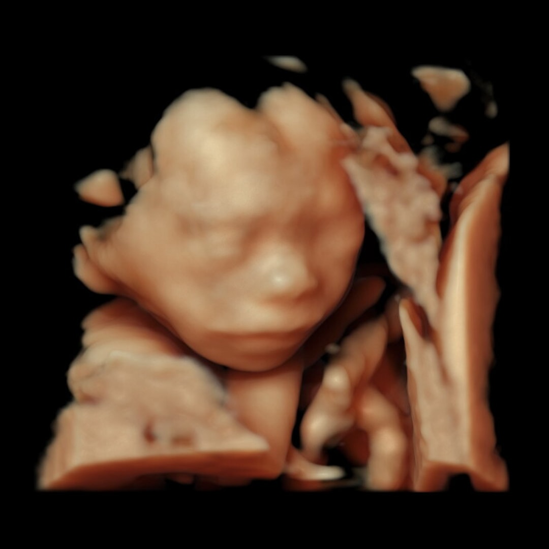 Photo shared by Eva for their Babylist baby registry.