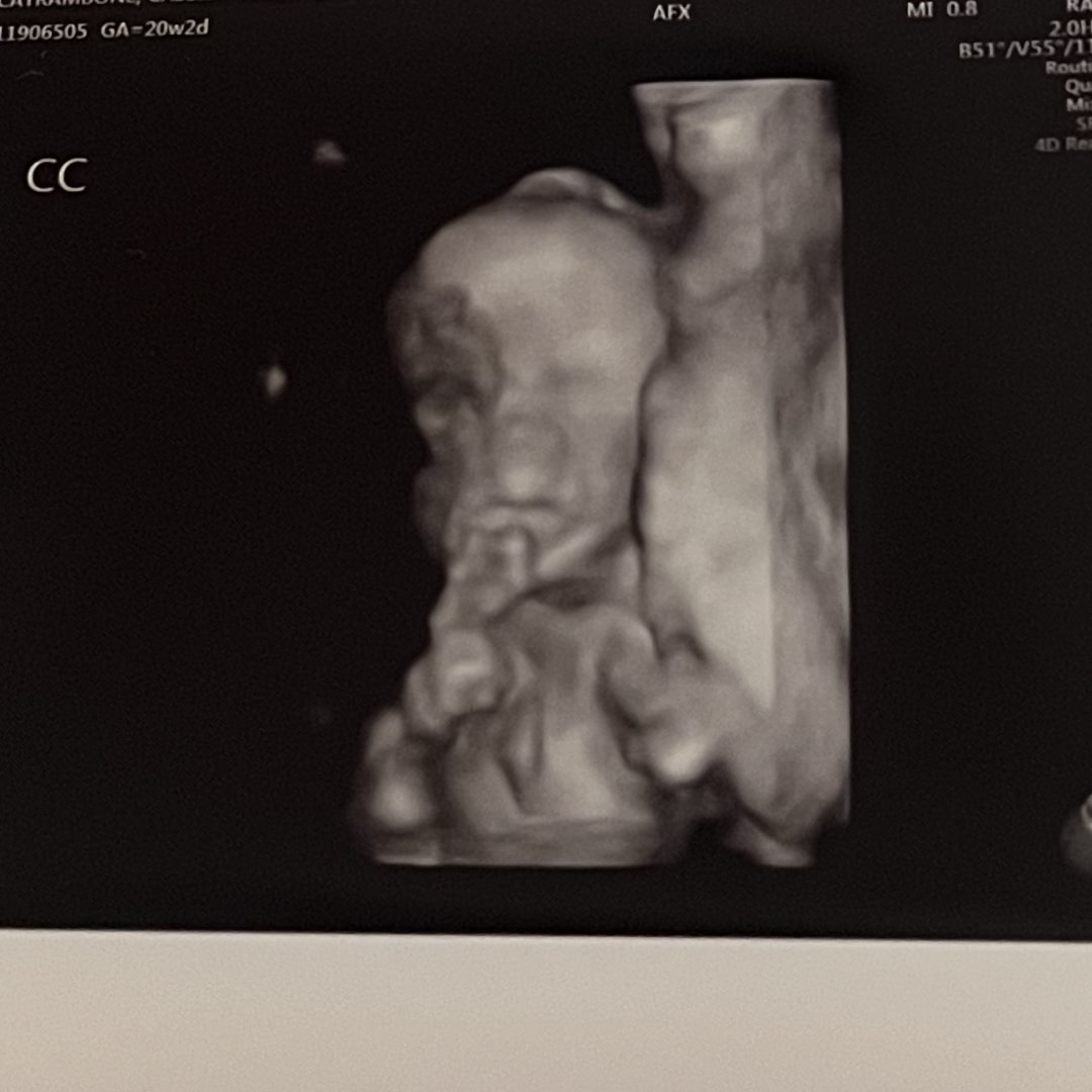 Photo shared by Cassidy for their Babylist baby registry.