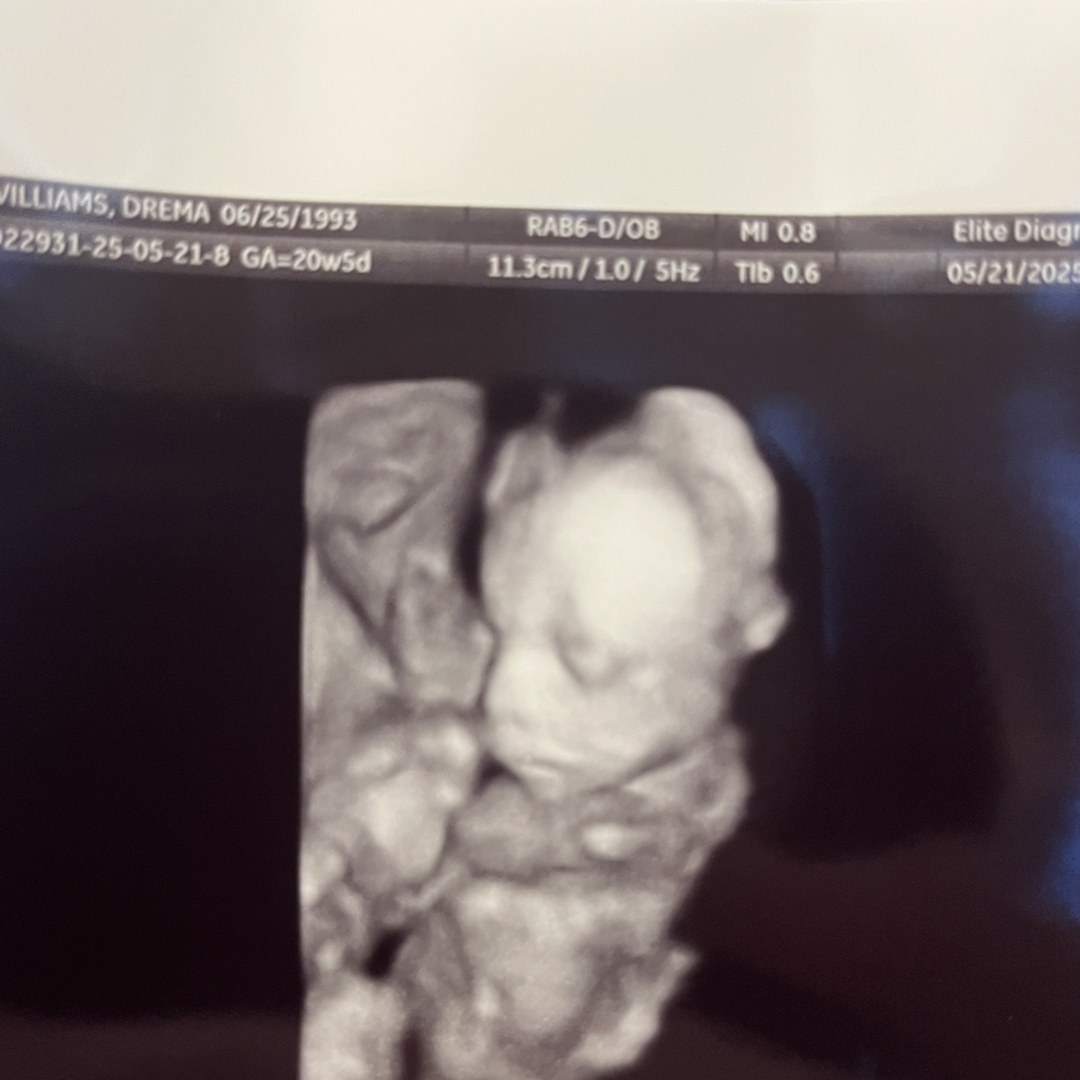 Photo shared by Drema for their Babylist baby registry.