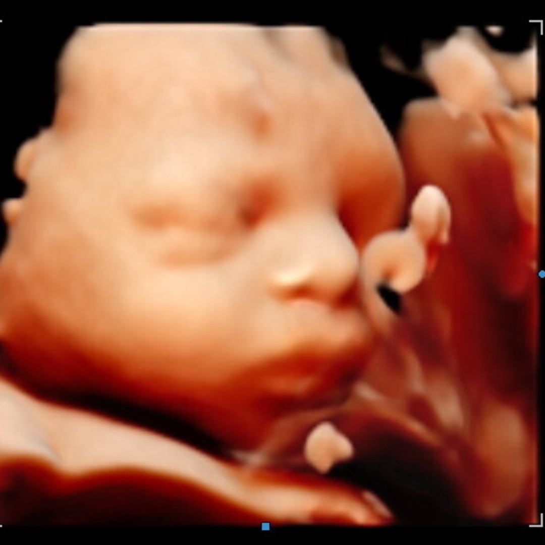 Photo shared by Amanda for their Babylist baby registry.