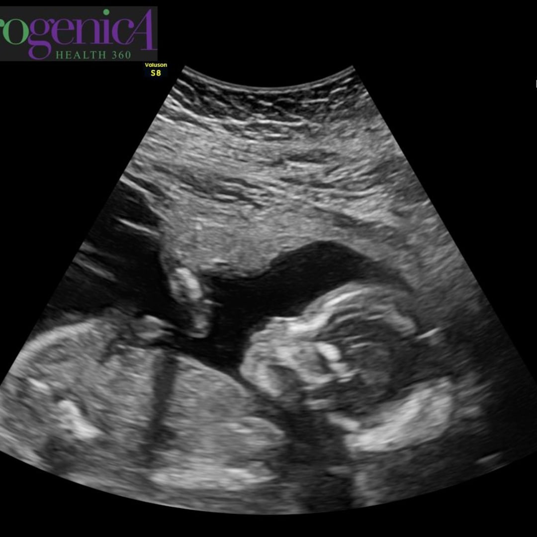 Photo shared by Carolyn for their Babylist baby registry.