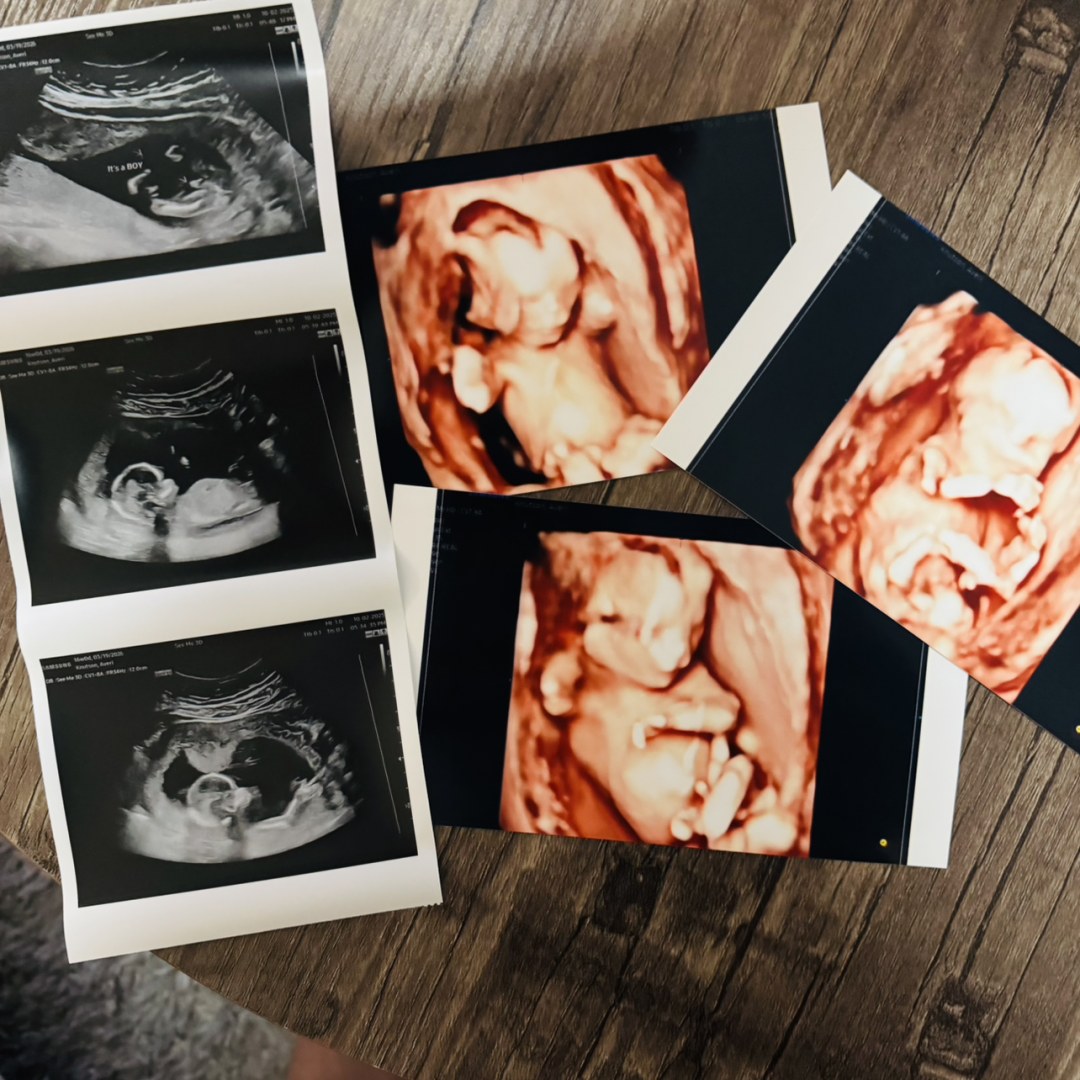 Photo shared by Averi for their Babylist baby registry.