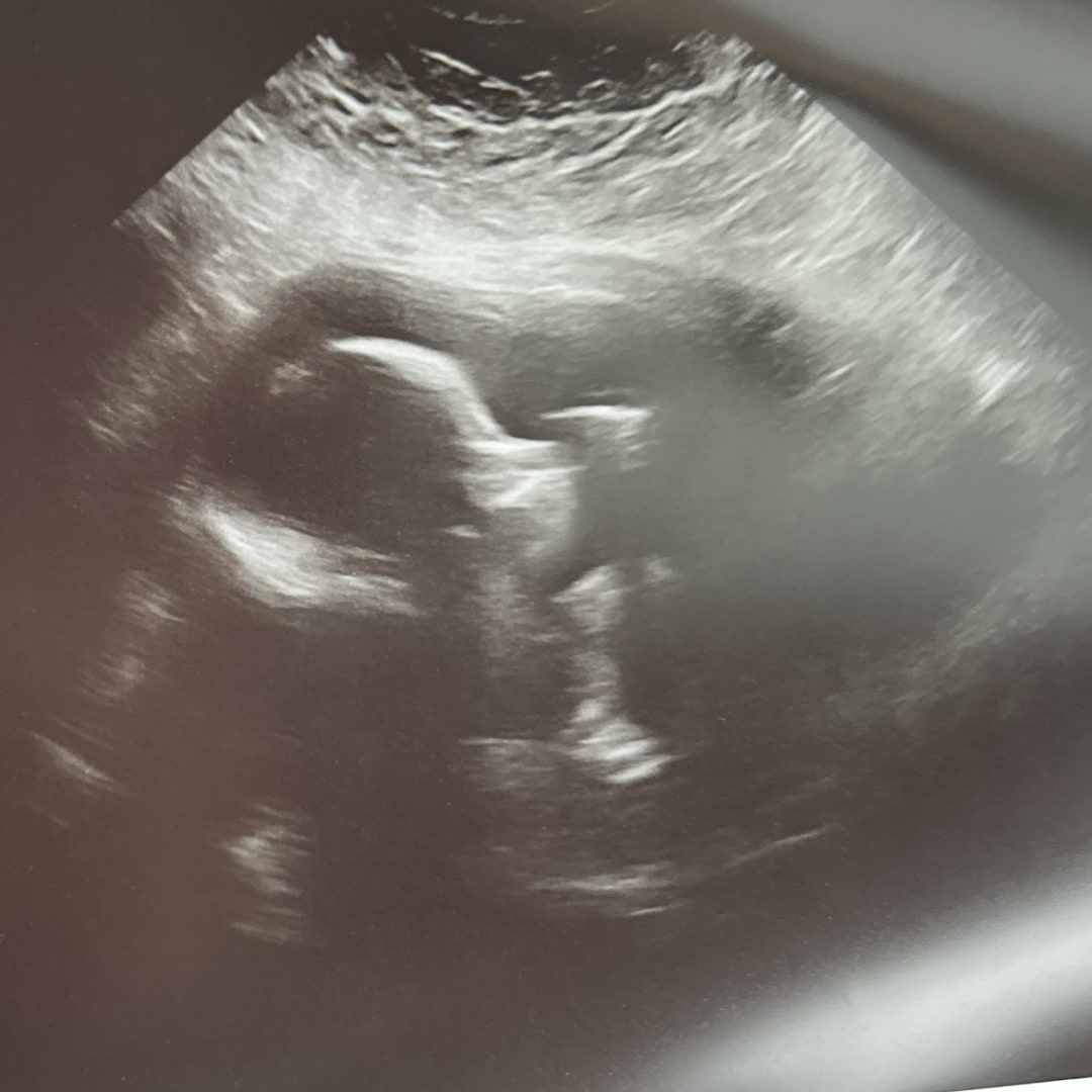 Photo shared by Samantha for their Babylist baby registry.