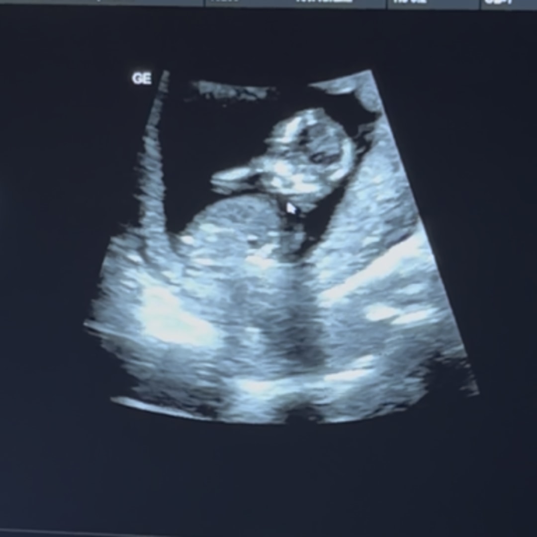 Photo shared by Jazmine for their Babylist baby registry.