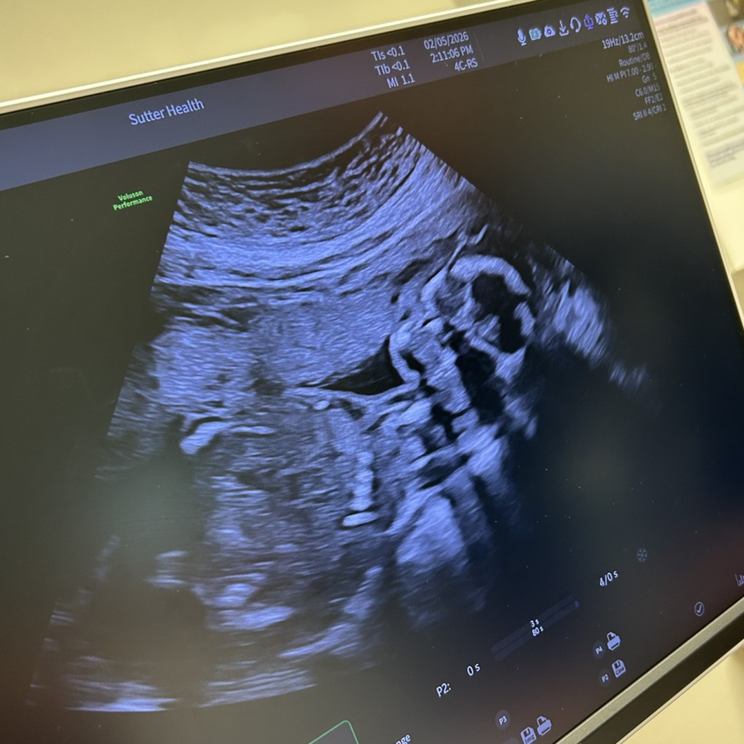 Photo shared by Alexx for their Babylist baby registry.