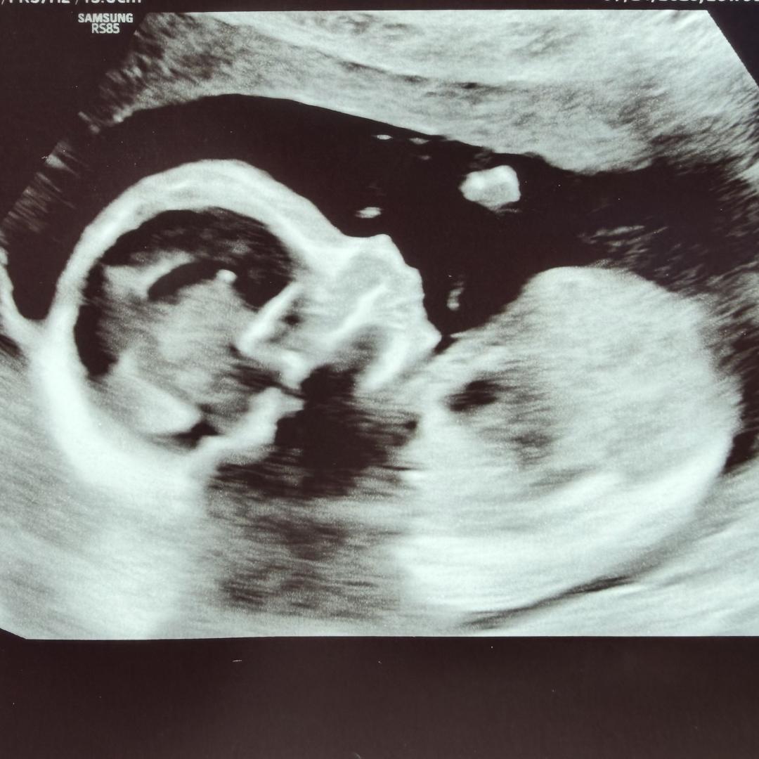 Photo shared by Kaylee for their Babylist baby registry.