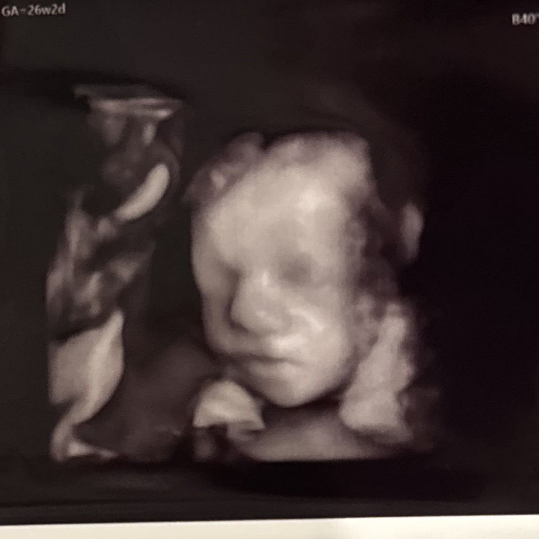 Photo shared by Rylie for their Babylist baby registry.