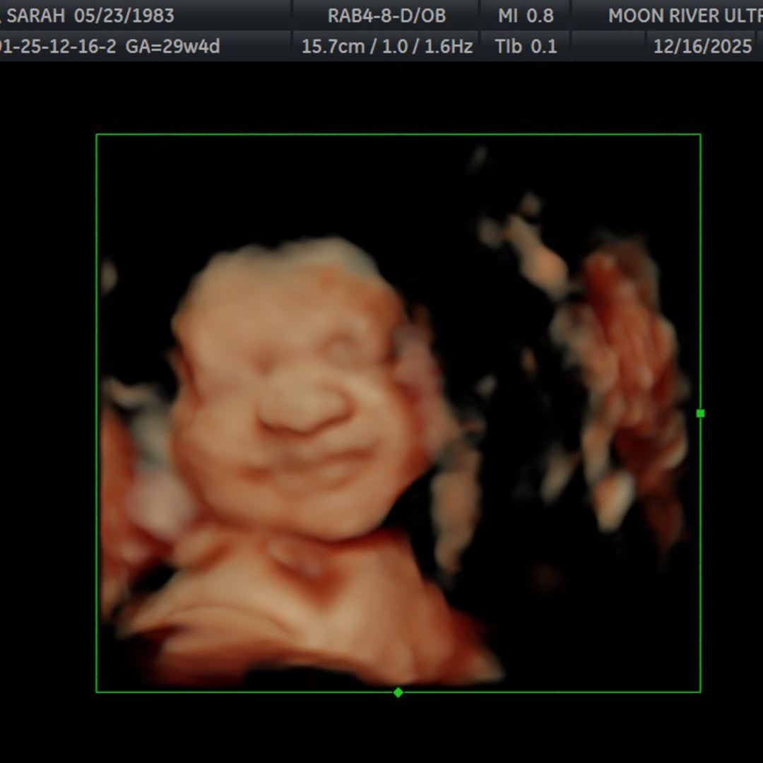 Photo shared by Sarah for their Babylist baby registry.