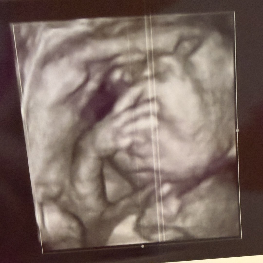 Photo shared by Caitlin for their Babylist baby registry.