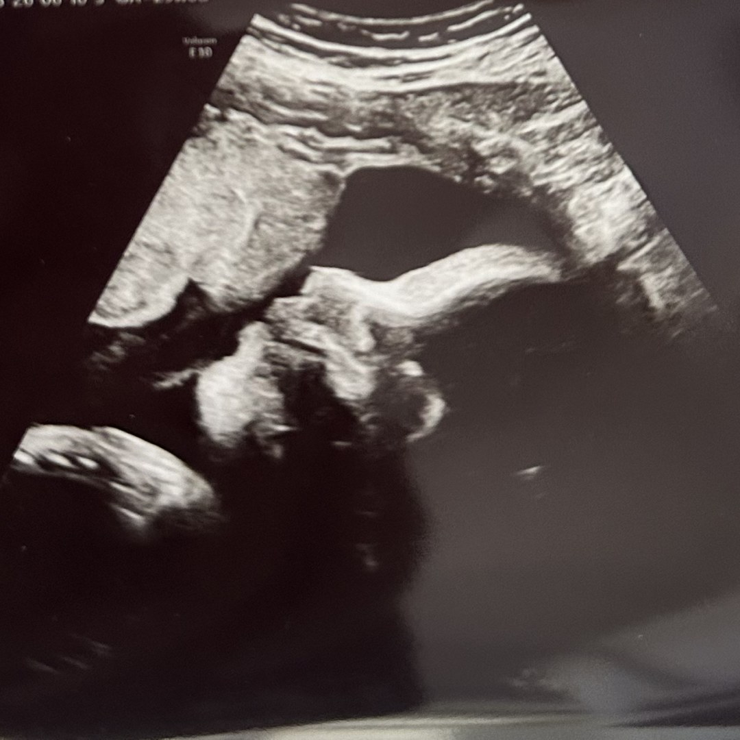 Photo shared by Giselle for their Babylist baby registry.