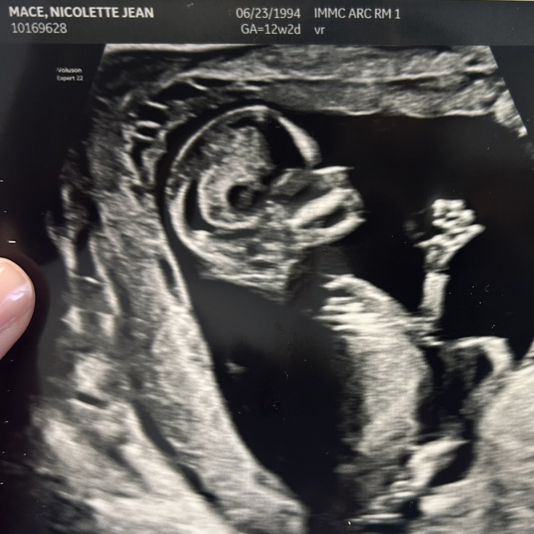 Photo shared by Nicolette for their Babylist baby registry.